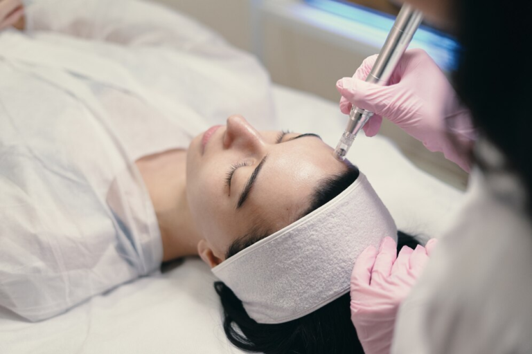 Microneedling